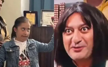 Autizmli uşağı parodiya edən İlkin: