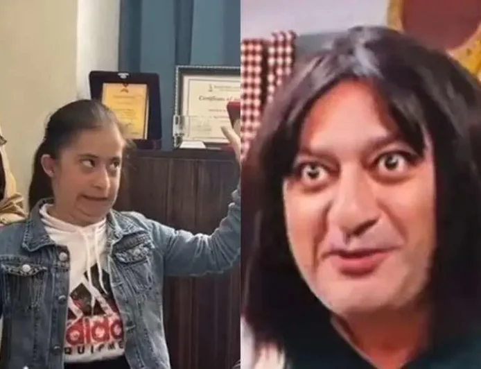 Autizmli uşağı parodiya edən İlkin: