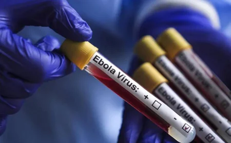Ebola sürətlə yayılır: