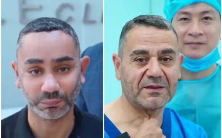 58 yaşlı kişinin gəncləşmək cəhdi: Vyetnamda tanınmaz hala düşdü
