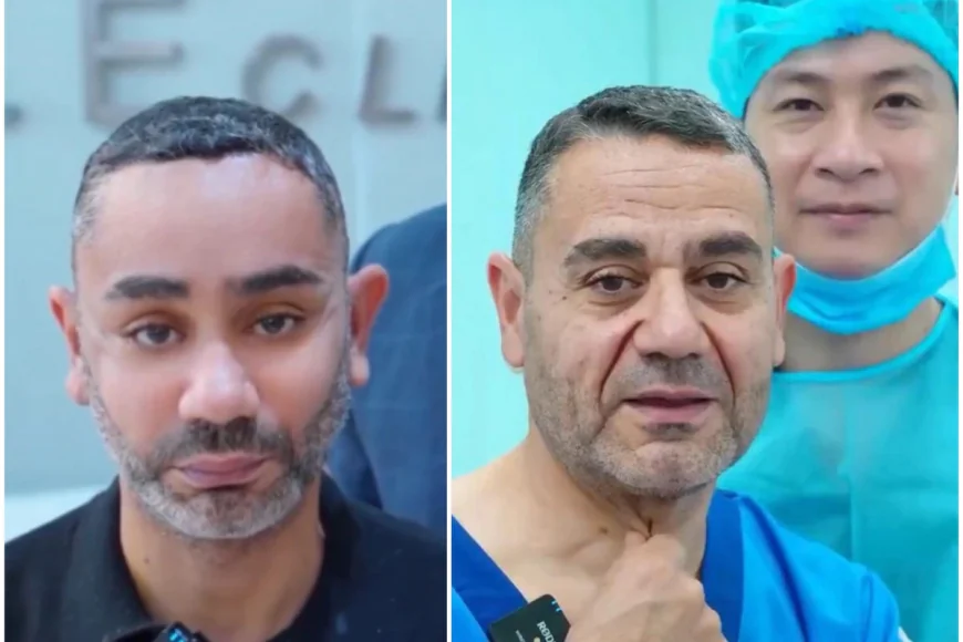 58 yaşlı kişinin gəncləşmək cəhdi: Vyetnamda tanınmaz hala düşdü